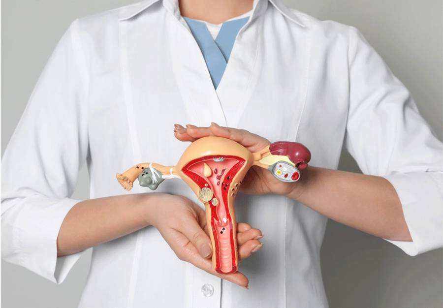 C&aacute;ncer de ovario puede ser curable en 90% de los casos detectados en etapa inicial: InCan