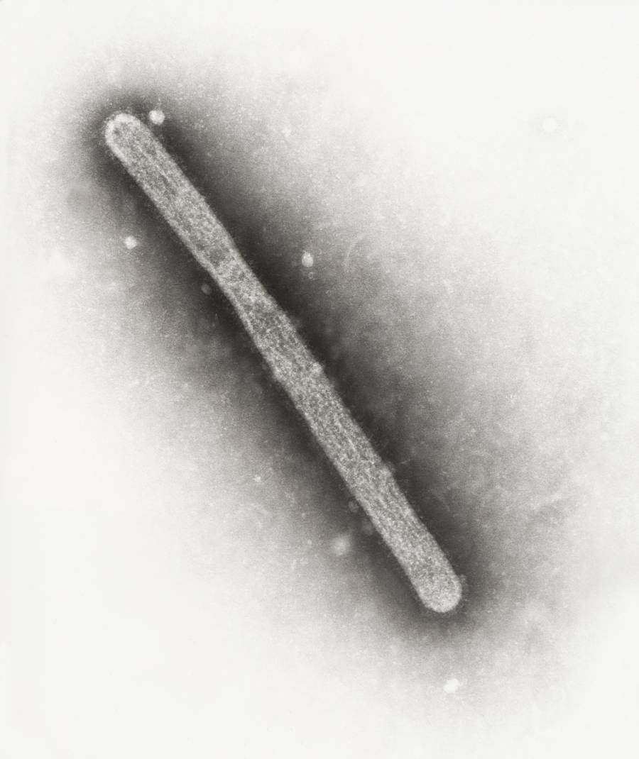 EUA reporta segundo caso de gripe aviaria em humanos