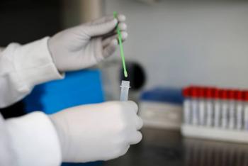 Enzimas bacterianas podr&iacute;an combatir resistencia a los antibi&oacute;ticos