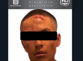 Procesan al agresor de una joven en Ecatepec; enfrenta cargos por lesiones con agravante de razones de g&eacute;nero