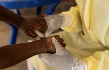 La OMS declara al mpox como nueva emergencia de salud p&uacute;blica internacional