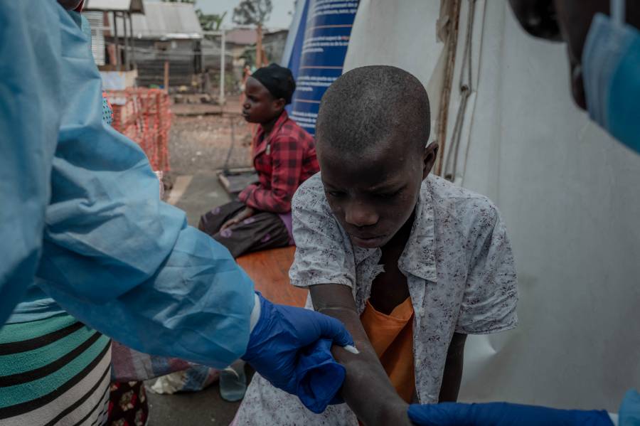 La OMS busca aumentar la producci&oacute;n de la vacuna contra el mpox