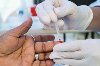 Jornada Nacional de Salud ofrece pruebas de detecci&oacute;n de hepatitis C, VIH y otras ITS