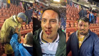 Violencia empa&ntilde;a el Cl&aacute;sico Capitalino entre Am&eacute;rica y Pumas
