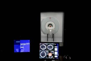 Descubren fluctuaciones diarias en el tama&ntilde;o del cerebro masculino