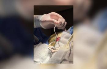 Gobierno del Estado realiza cirug&iacute;as gratuitas para tratar cardiopat&iacute;as cong&eacute;nitas en menores