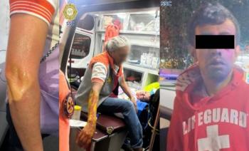 Nuevo ataque con aceite caliente en la Ciudad de M&eacute;xico: dos mujeres lesionadas en la alcald&iacute;a Cuauht&eacute;moc