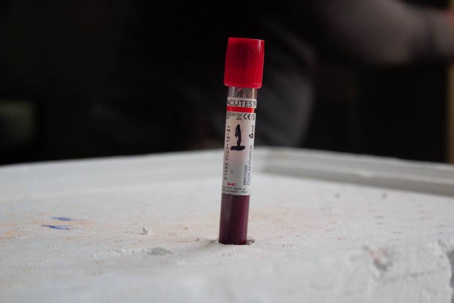 Fallece interno en penal de Tepic por tuberculosis pulmonar; activan protocolos sanitarios