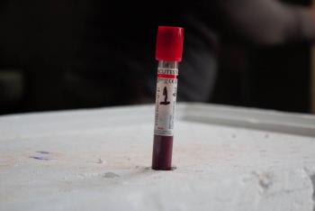 Fallece interno en penal de Tepic por tuberculosis pulmonar; activan protocolos sanitarios