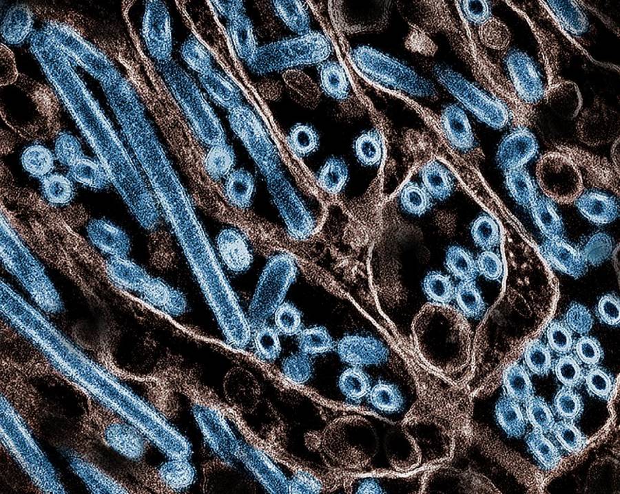Confirman primer caso humano de influenza aviar H5N1 en México
