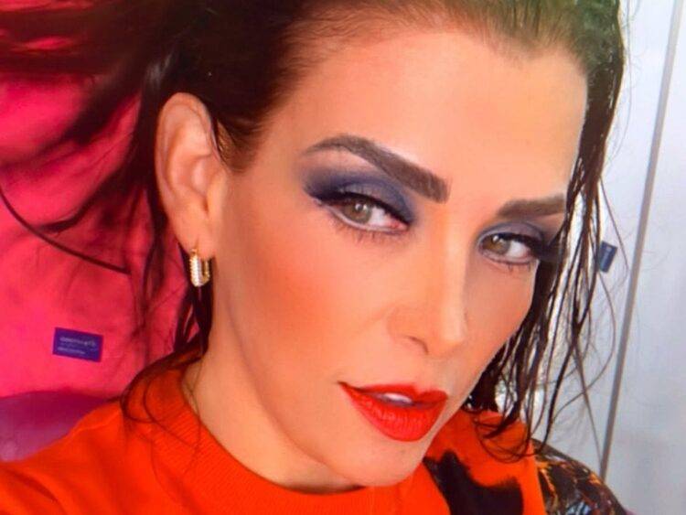 Lisset sufre fuerte accidente en la calle