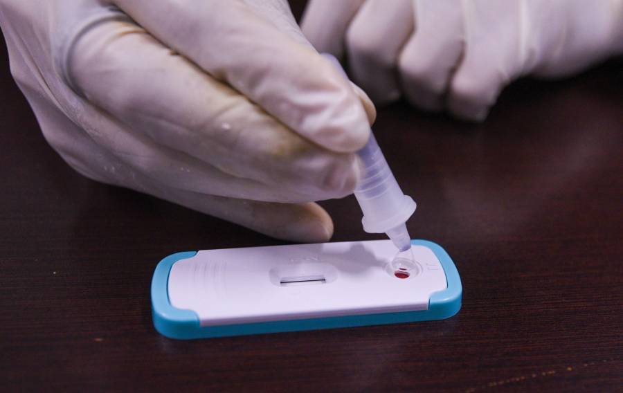 Píldora mensual para prevenir el VIH: un avance prometedor en salud pública
