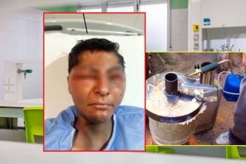 Estudiante de Chihuahua pierde la vista tras accidente escolar; CEDH exige reparaci&oacute;n integral del da&ntilde;o