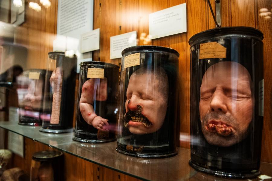 Esqueletos an&oacute;nimos: un museo de EEUU en el centro de un debate &eacute;tico