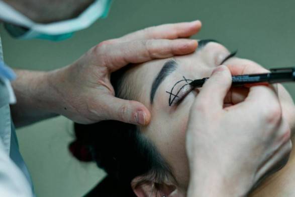 80% de pacientes con cirugía estética presenta trastorno dismórfico
