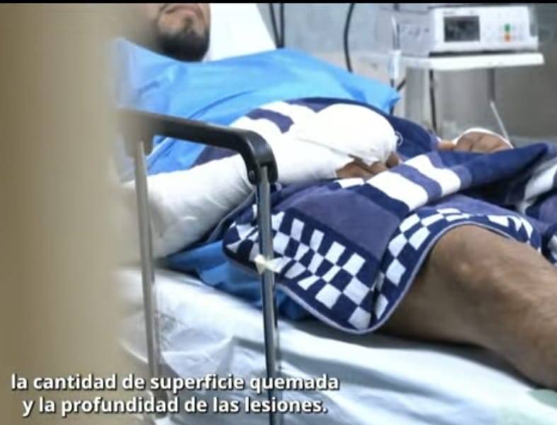 41 personas con quemaduras por explosión de pipa en Iztapalapa recibieron atención en el Rubén Leñero; tres siguen internas