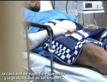 41 personas con quemaduras por explosi&oacute;n de pipa en Iztapalapa recibieron atenci&oacute;n en el Rub&eacute;n Le&ntilde;ero; tres siguen internas