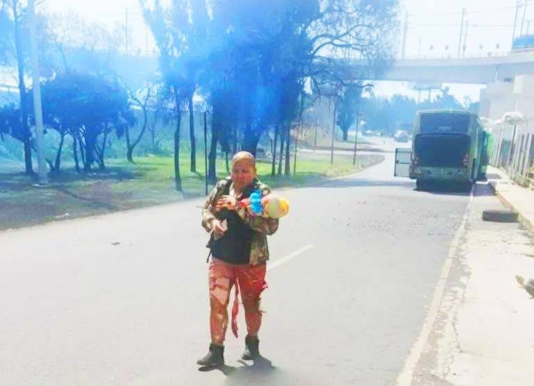 Niña víctima de explosión de pipa en Iztapalapa evoluciona favorablemente en Texas