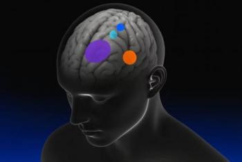 Implante cerebral buscar&aacute; restaurar la voz en personas con par&aacute;lisis severa