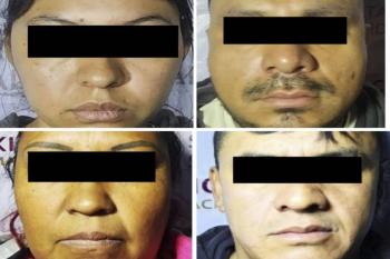Cuatro detenidos en operativos contra narcomenudeo en CDMX