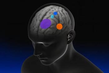 Una startup china busca competir en la carrera global por la neurotecnolog&iacute;a