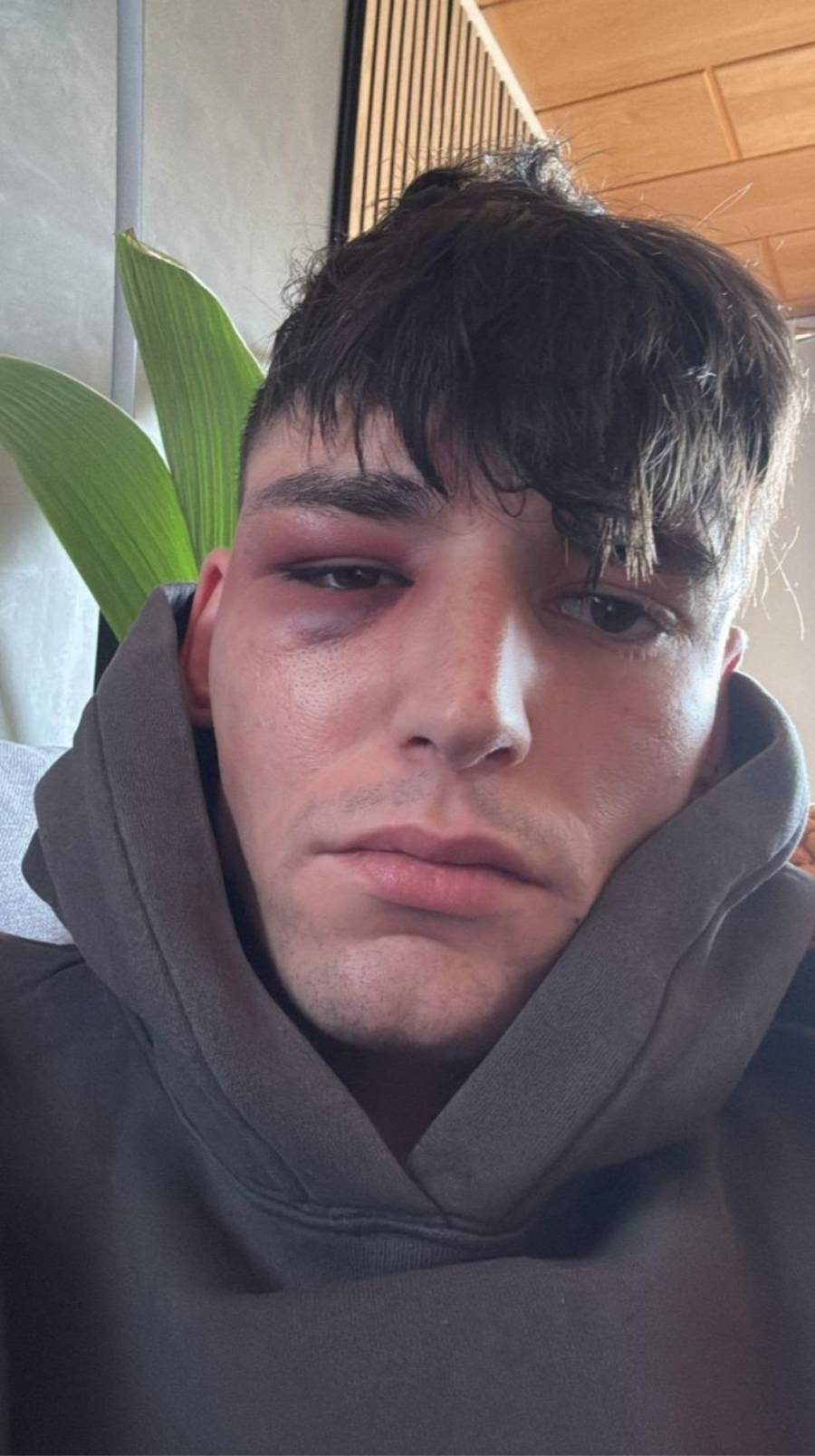 &Aacute;rbitro alem&aacute;n es agredido en su casa tras proponer matrimonio a su pareja en partido de la Bundesliga