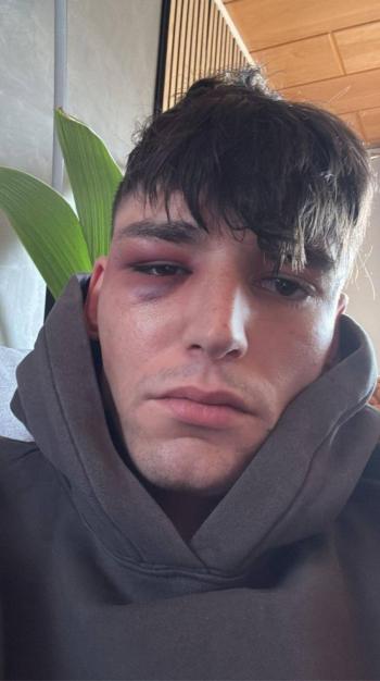 &Aacute;rbitro alem&aacute;n es agredido en su casa tras proponer matrimonio a su pareja en partido de la Bundesliga