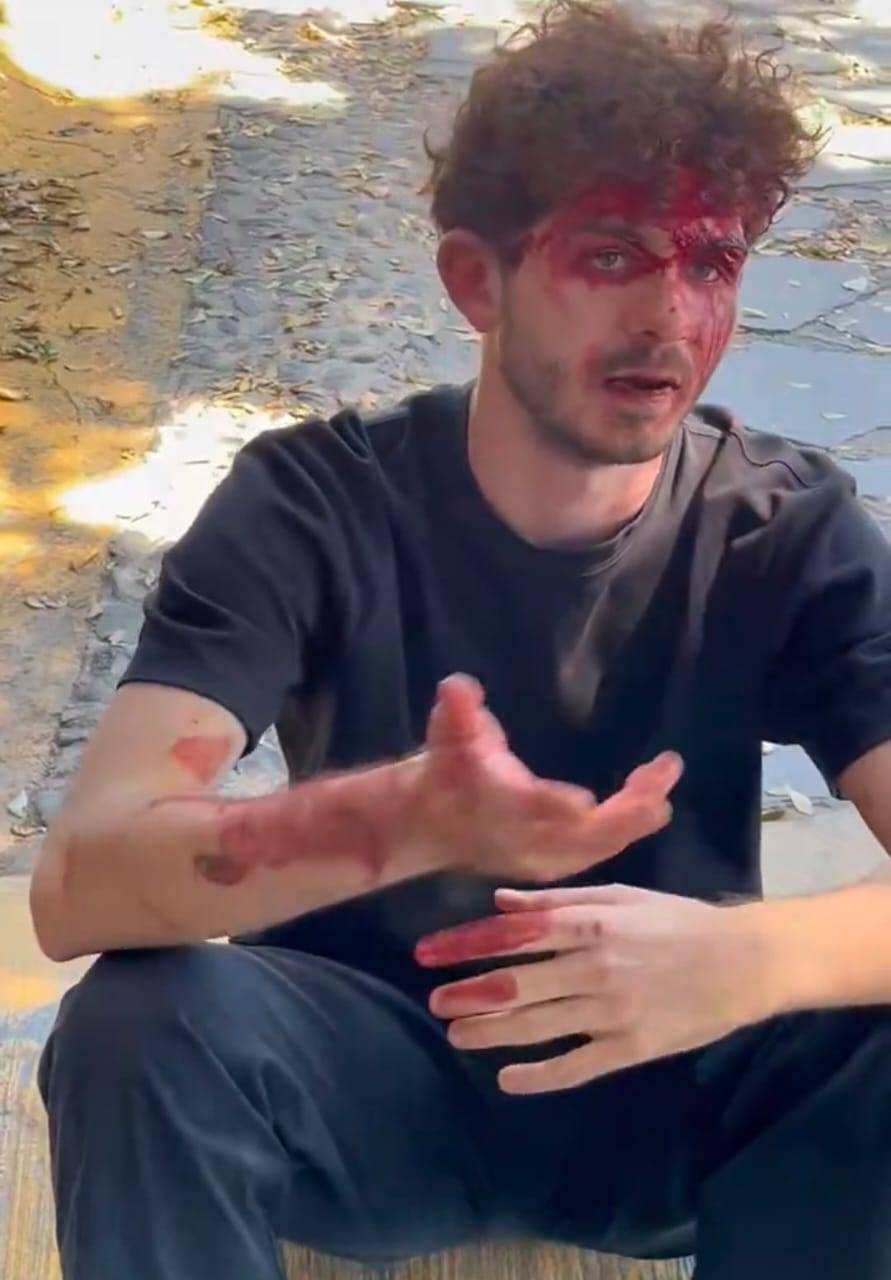 Agresi&oacute;n a estudiante Italiano de intercambio en entierro de El Mencho en Zapopan se hace viral