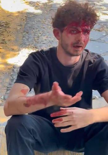 Agresi&oacute;n a estudiante Italiano de intercambio en entierro de El Mencho en Zapopan se hace viral