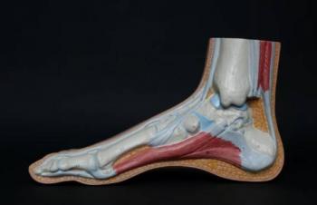 Detectan fracturas por estr&eacute;s por dolor persistente en pie, tibia e ingle
