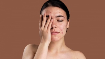 Estr&eacute;s y piel: la ciencia revela c&oacute;mo las emociones afectan la salud cut&aacute;nea