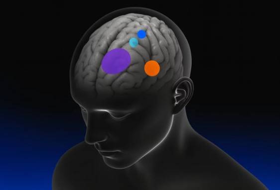 Cambios en ADN del cerebro abren nuevas rutas para entender el Alzheimer