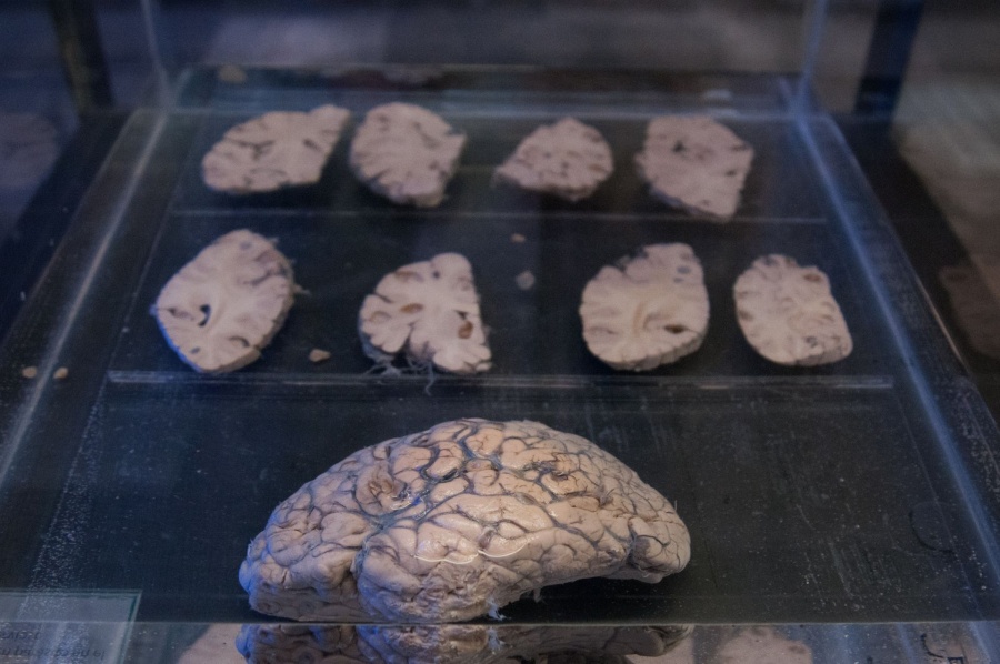 Indicadores de deterioro cognitivo m&aacute;s potentes que los olvidos, seg&uacute;n neur&oacute;logo