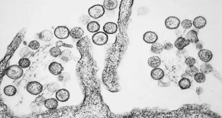 Chile reporta aumento de casos de hantavirus en 2026; variante Andes predomina en el país