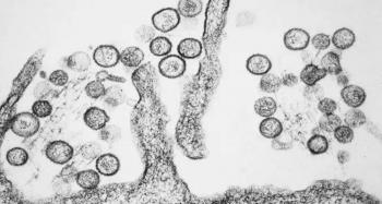 Chile reporta aumento de casos de hantavirus en 2026; variante Andes predomina en el pa&iacute;s