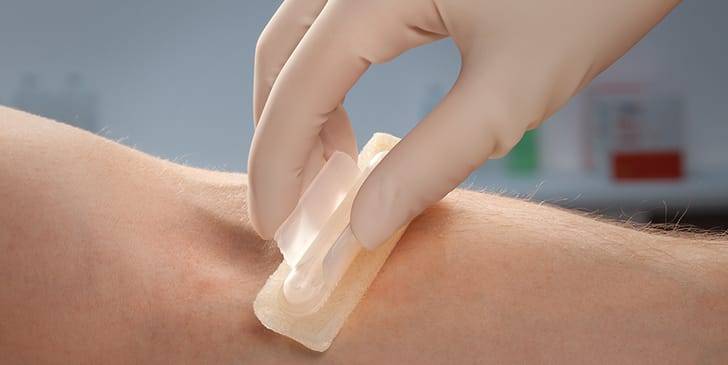 Investigación mexicana demuestra eficacia de antiséptico para garantizar seguridad en donaciones de sangre    