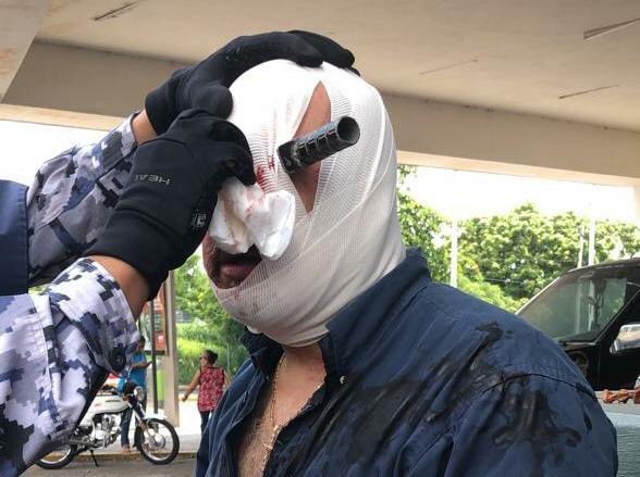 Hombre pierde el ojo tras una riña por un lugar de estacionamiento